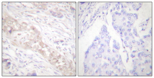 Immunohistochemistry (Formalin/PFA-fixed paraffin-embedded sections) - Anti-Smad2 (phospho S467) antibody (AB53100)