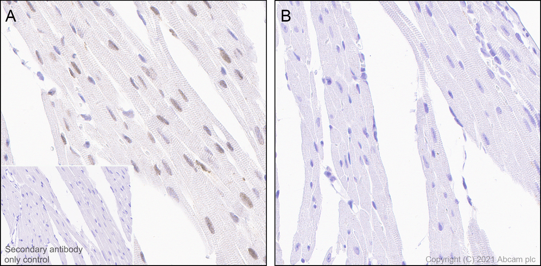 Immunohistochemistry (Formalin/PFA-fixed paraffin-embedded sections) - Anti-Smad2 (phospho S467) antibody [EPR23681-40] (ab280888), expandable thumbnail