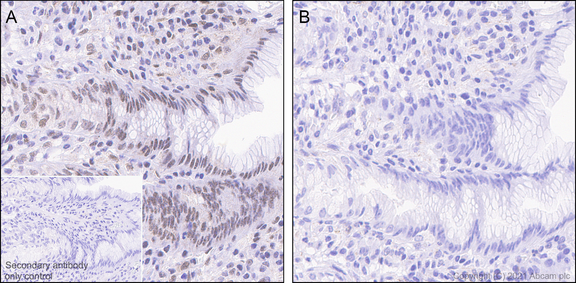 Immunohistochemistry (Formalin/PFA-fixed paraffin-embedded sections) - Anti-Smad2 (phospho S467) antibody [EPR23681-40] (AB280888), expandable thumbnail