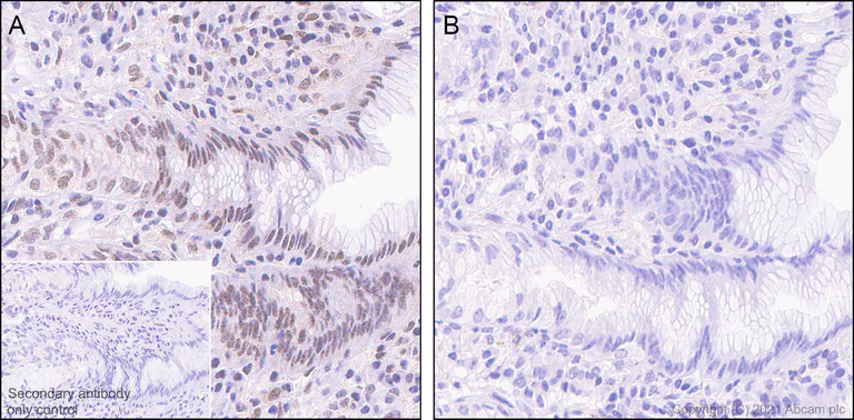 Immunohistochemistry (Formalin/PFA-fixed paraffin-embedded sections) - Anti-Smad2 (phospho S467) antibody [EPR23681-40] (AB280888)