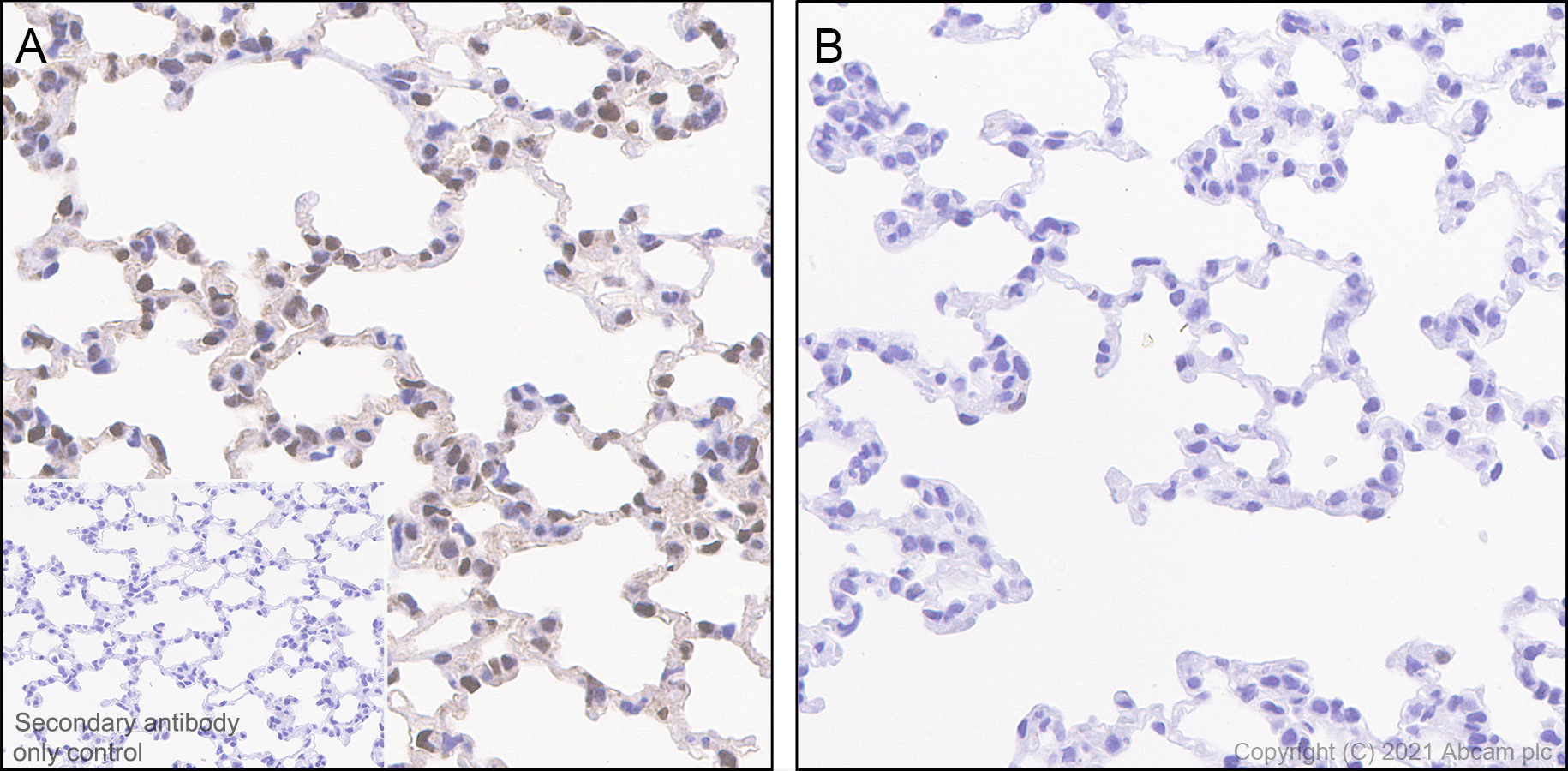 Immunohistochemistry (Formalin/PFA-fixed paraffin-embedded sections) - Anti-Smad2 (phospho S467) antibody [EPR23681-40] (ab280888), expandable thumbnail