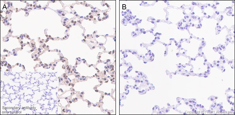 Immunohistochemistry (Formalin/PFA-fixed paraffin-embedded sections) - Anti-Smad2 (phospho S467) antibody [EPR23681-40] (AB280888)