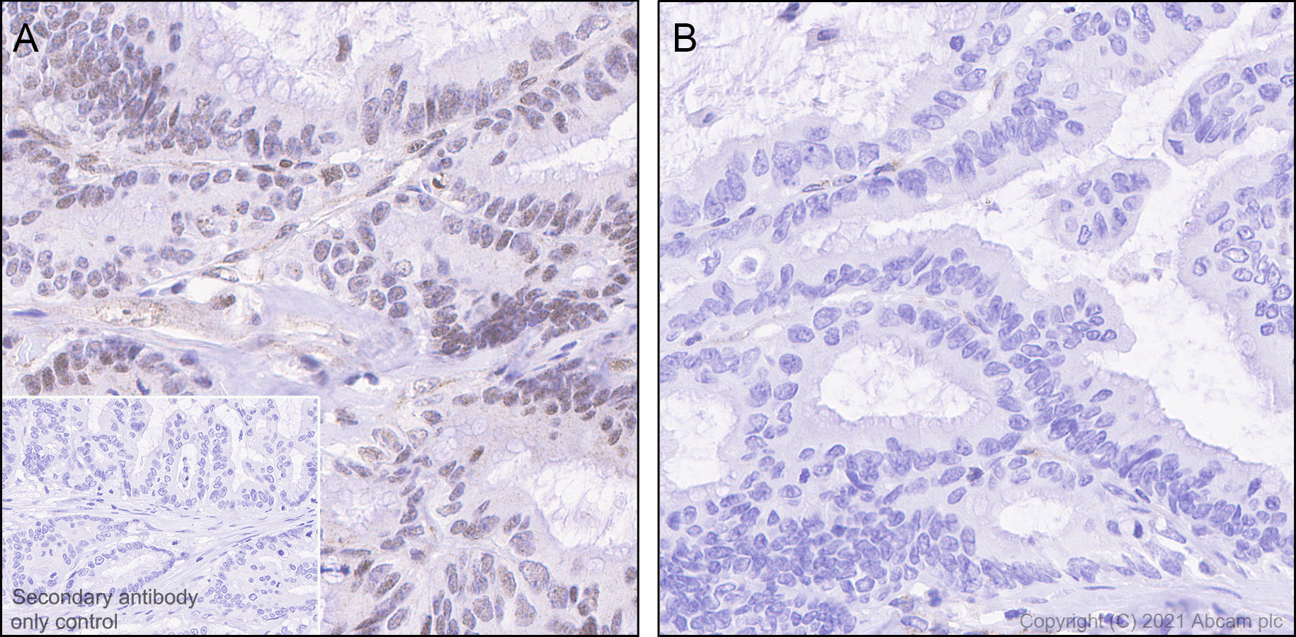 Immunohistochemistry (Formalin/PFA-fixed paraffin-embedded sections) - Anti-Smad2 (phospho S467) antibody [EPR23681-40] (ab280888), expandable thumbnail