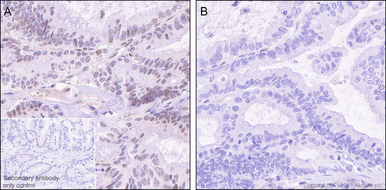 Immunohistochemistry (Formalin/PFA-fixed paraffin-embedded sections) - Anti-Smad2 (phospho S467) antibody [EPR23681-40] (AB280888)