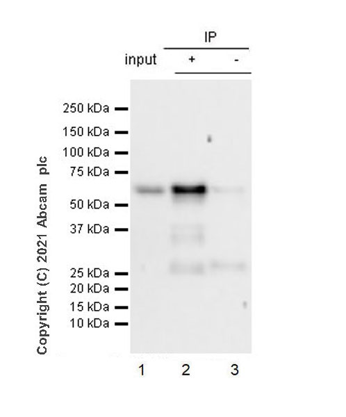 Immunoprecipitation - Anti-Smad2 (phospho S467) antibody [EPR23681-40] (ab280888), expandable thumbnail