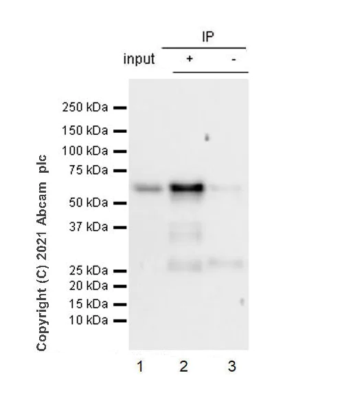 Immunoprecipitation - Anti-Smad2 (phospho S467) antibody [EPR23681-40] (AB280888)