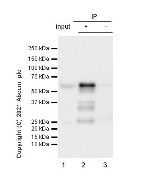 Immunoprecipitation - Anti-Smad2 (phospho S467) antibody [EPR23681-40] (AB280888), expandable thumbnail