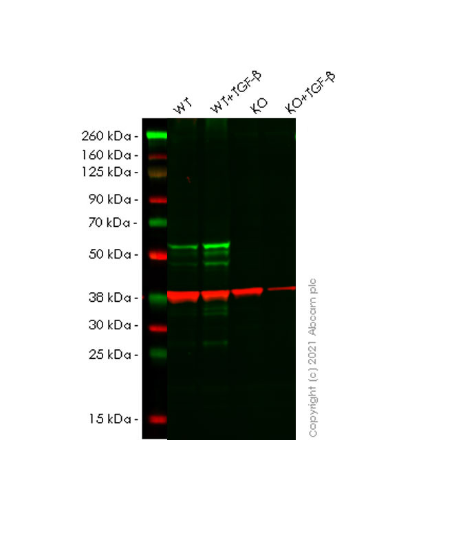 Western blot - Anti-Smad2 (phospho S467) antibody [EPR23681-40] (AB280888), expandable thumbnail