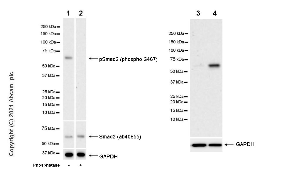 Western blot - Anti-Smad2 (phospho S467) antibody [EPR23681-40] (ab280888), expandable thumbnail
