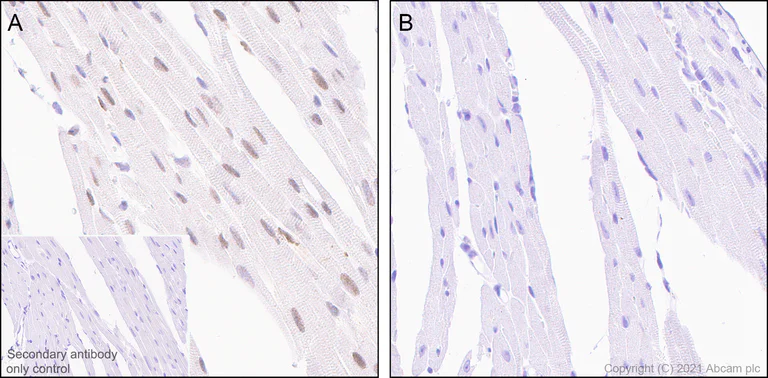 Immunohistochemistry (Formalin/PFA-fixed paraffin-embedded sections) - Anti-Smad2 (phospho S467) antibody [EPR23681-40] - BSA and Azide free (AB280897)
