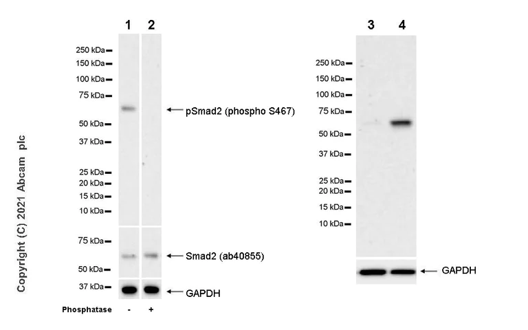 Western blot - Anti-Smad2 (phospho S467) antibody [EPR23681-40] - BSA and Azide free (AB280897)
