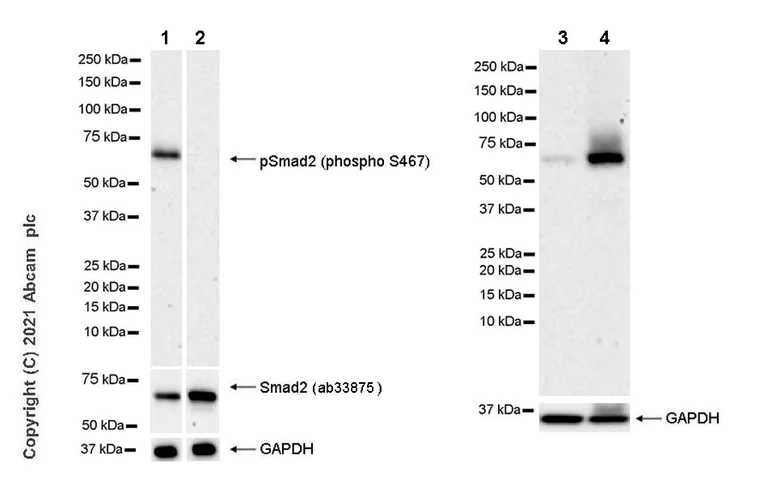 Western blot - Anti-Smad2 (phospho S467) antibody [EPR23681-40] - BSA and Azide free (AB280897)