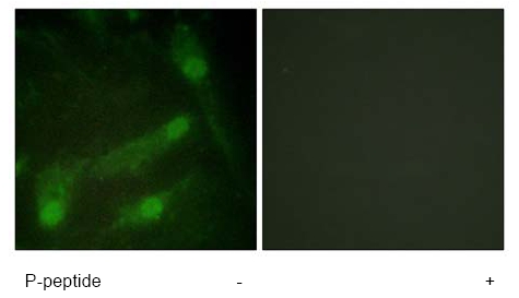 Immunocytochemistry/ Immunofluorescence - Anti-Smad2 (phospho T220) antibody (AB61066)