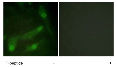 Immunocytochemistry/ Immunofluorescence - Anti-Smad2 (phospho T220) antibody (AB61066)