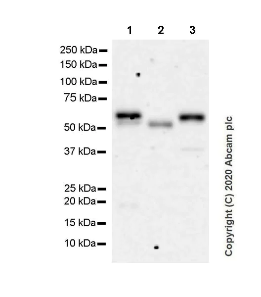 Western blot - Anti-Smad2 (phospho T8) + Smad3 (phospho T8) antibody [EPR23682-64] - BSA and Azide free (AB276140)