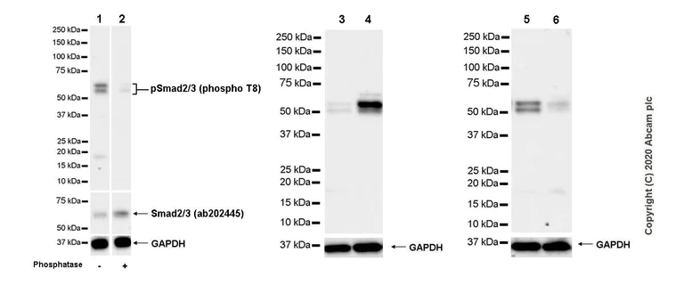 Western blot - Anti-Smad2 (phospho T8) + Smad3 (phospho T8) antibody [EPR23682-64] - BSA and Azide free (AB276140)