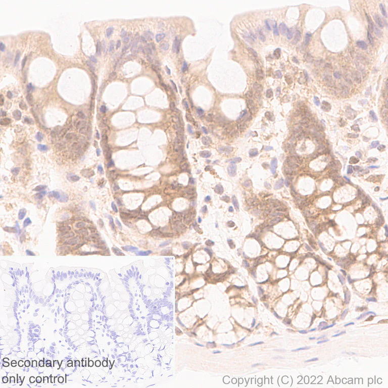 Immunohistochemistry - Anti-Smad2 + Smad3 antibody [18/Smad2/3] (AB305325)