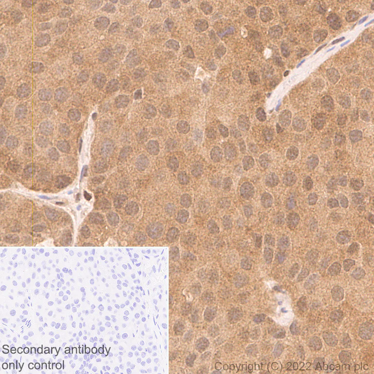 Immunohistochemistry - Anti-Smad2 + Smad3 antibody [18/Smad2/3] (AB305325)