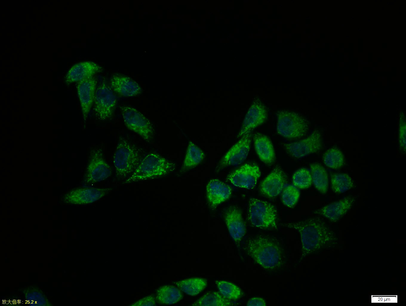 Immunocytochemistry/ Immunofluorescence - Anti-Smad2 + Smad3 antibody (AB217553), expandable thumbnail