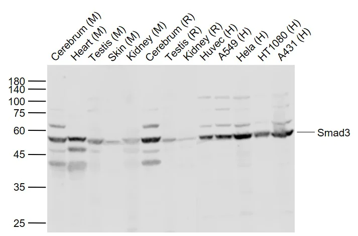 Western blot - Anti-Smad2 + Smad3 antibody (AB217553)
