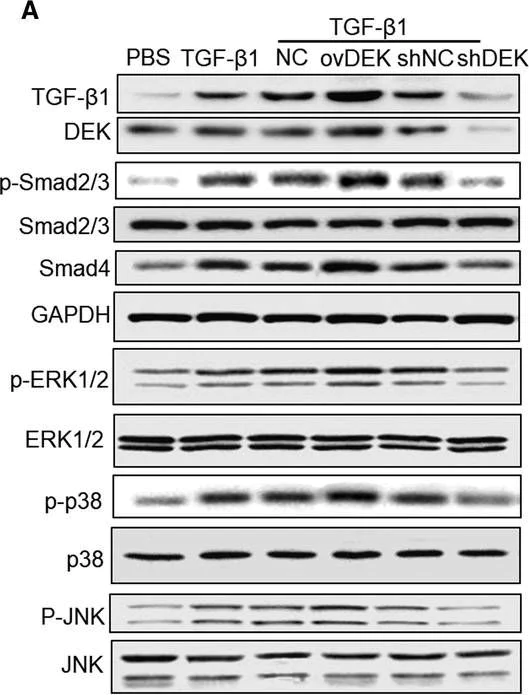 Western blot - Anti-Smad2 + Smad3 antibody [EPR19557-4] - ChIP Grade (AB202445)