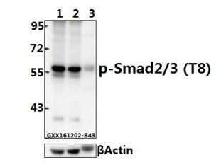 Western blot - Anti-Smad2 + Smad3 (phospho T8) antibody (AB272332)