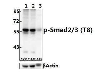 Western blot - Anti-Smad2 + Smad3 (phospho T8) antibody (AB272332)