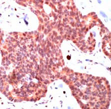 Immunohistochemistry (Formalin/PFA-fixed paraffin-embedded sections) - Anti-Smad3 antibody (AB28379), expandable thumbnail