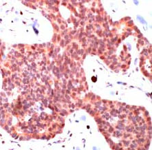 Immunohistochemistry (Formalin/PFA-fixed paraffin-embedded sections) - Anti-Smad3 antibody (AB28379)