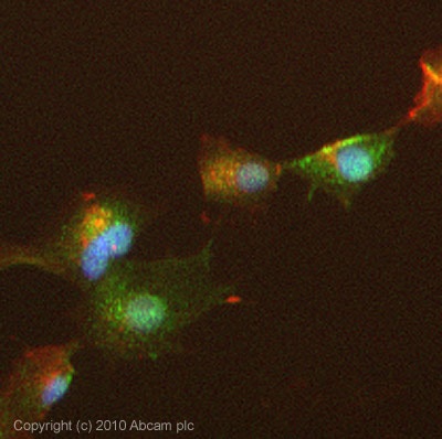 Immunocytochemistry/ Immunofluorescence - Anti-Smad3 antibody (AB84177), expandable thumbnail