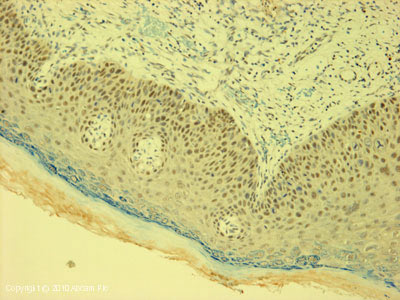 Immunohistochemistry (Formalin/PFA-fixed paraffin-embedded sections) - Anti-Smad3 antibody (AB84177), expandable thumbnail
