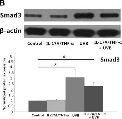 Western blot - Anti-Smad3 antibody (ab84177), expandable thumbnail