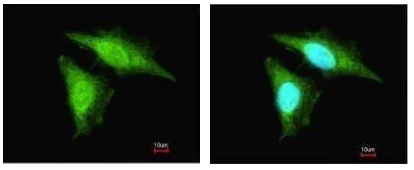 Immunocytochemistry/ Immunofluorescence - Anti-Smad3 antibody - ChIP Grade (AB227223)