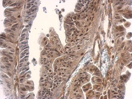 Immunohistochemistry (Formalin/PFA-fixed paraffin-embedded sections) - Anti-Smad3 antibody - ChIP Grade (ab227223), expandable thumbnail