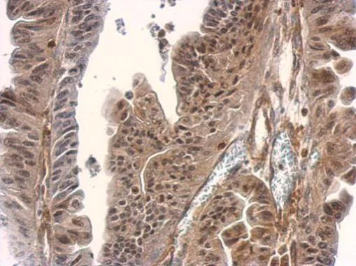 Immunohistochemistry (Formalin/PFA-fixed paraffin-embedded sections) - Anti-Smad3 antibody - ChIP Grade (AB227223)