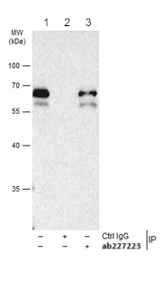Immunoprecipitation - Anti-Smad3 antibody - ChIP Grade (AB227223)