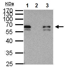 Immunoprecipitation - Anti-Smad3 antibody - ChIP Grade (AB227223), expandable thumbnail