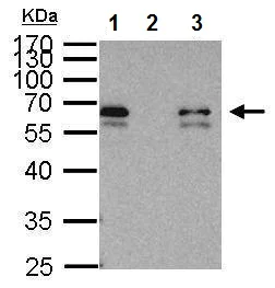 Immunoprecipitation - Anti-Smad3 antibody - ChIP Grade (AB227223)
