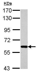 Western blot - Anti-Smad3 antibody - ChIP Grade (AB227223), expandable thumbnail