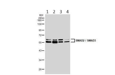 Western blot - Anti-Smad3 antibody - ChIP Grade (AB227223)