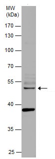 Western blot - Anti-Smad3 antibody - ChIP Grade (AB227223), expandable thumbnail