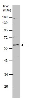 Western blot - Anti-Smad3 antibody - ChIP Grade (AB227223), expandable thumbnail