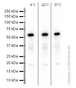Western blot - Anti-Smad3 antibody [EP568Y] (AB40854)