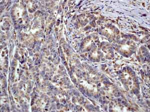 Immunohistochemistry (Formalin/PFA-fixed paraffin-embedded sections) - Anti-Smad3 antibody [EP568Y] - BSA and Azide free (ab157372), expandable thumbnail