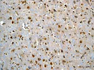 Immunohistochemistry (Formalin/PFA-fixed paraffin-embedded sections) - Anti-Smad3 antibody [EP568Y] - BSA and Azide free (ab157372), expandable thumbnail
