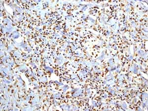 Immunohistochemistry (Formalin/PFA-fixed paraffin-embedded sections) - Anti-Smad3 antibody [EP568Y] - BSA and Azide free (ab157372), expandable thumbnail