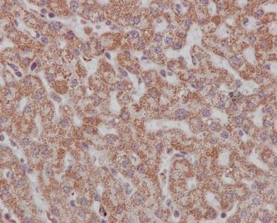 Immunohistochemistry (Formalin/PFA-fixed paraffin-embedded sections) - Anti-Smad3 antibody [EP568Y] - BSA and Azide free (AB157372), expandable thumbnail