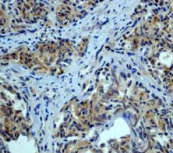 Immunohistochemistry (Formalin/PFA-fixed paraffin-embedded sections) - Anti-Smad3 antibody [EP568Y] - BSA and Azide free (ab157372), expandable thumbnail