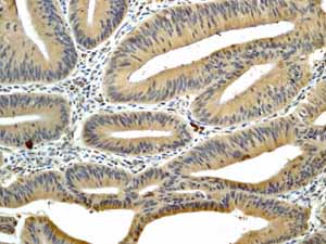 Immunohistochemistry (Formalin/PFA-fixed paraffin-embedded sections) - Anti-Smad3 antibody [EP568Y] - BSA and Azide free (ab157372), expandable thumbnail