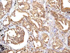 Immunohistochemistry (Formalin/PFA-fixed paraffin-embedded sections) - Anti-Smad3 antibody [EP568Y] - BSA and Azide free (ab157372), expandable thumbnail